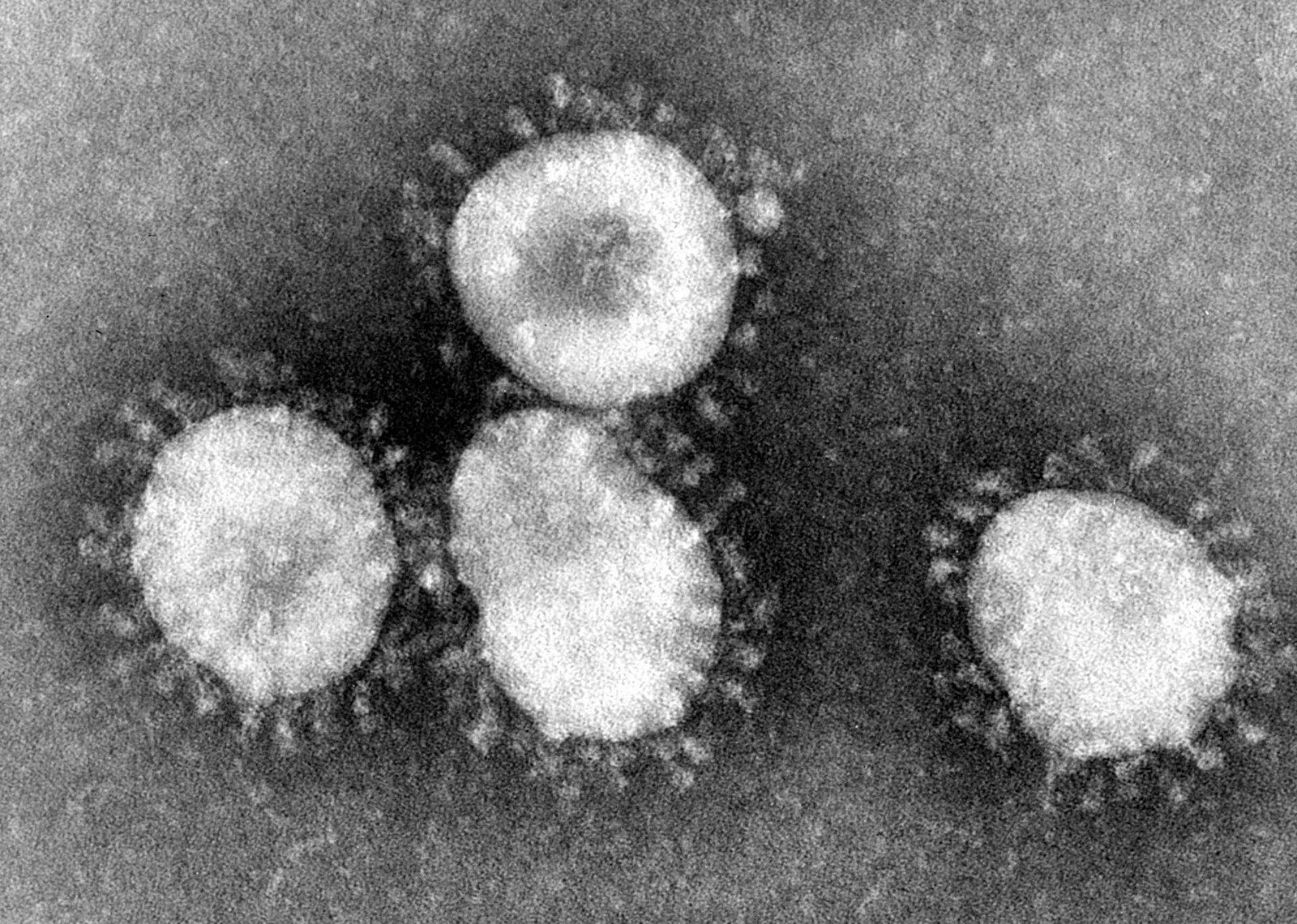 1600px-Coronaviruses_004_lores.jpg